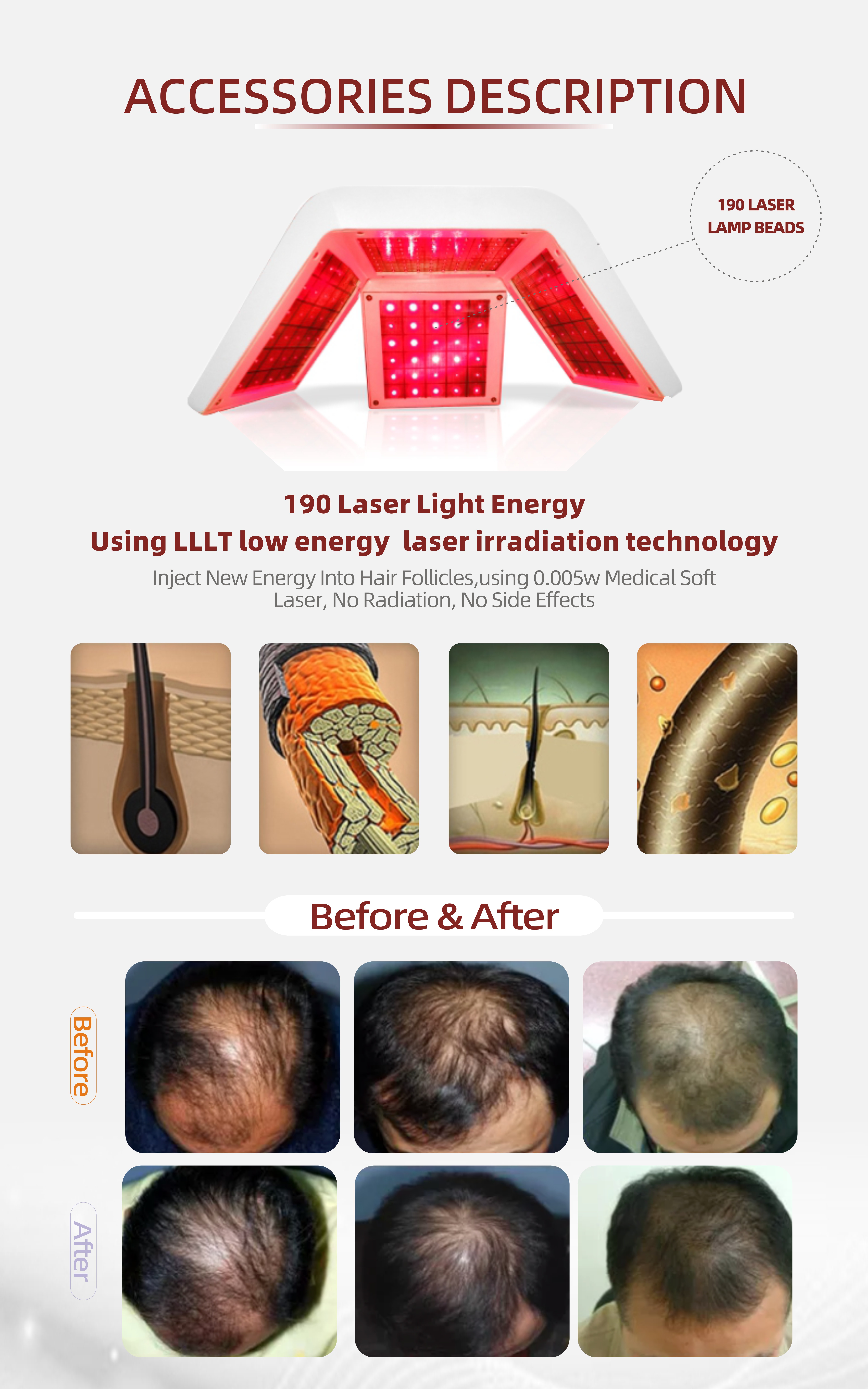 Laser Hair Growth Machine  