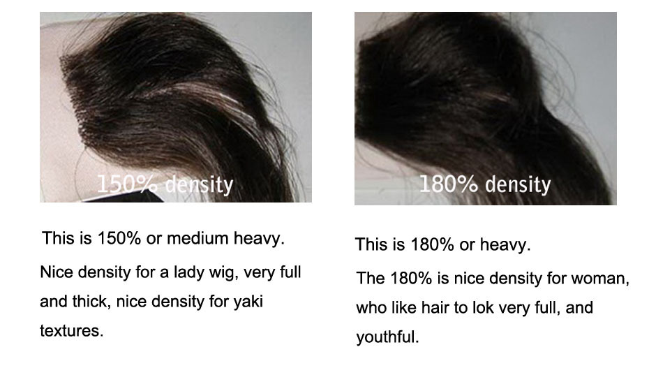 Hair Density Chart