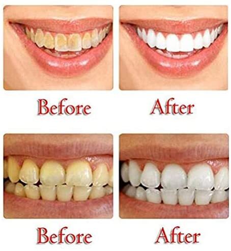 【New】Vista Toothpaste, Kokosnuss Bambus Mint Teeth Whitening Zahnpasta Ohne Fluorid, Tee Kaffee Fleck Entfernen (Coconut Zahnpasta 2 Pack) 【coming soon】vista zahnpasta kokosnuss bambus mint teeth whitening zahnpasta ohne fluorid tee kaffee fleck entfernen (coconut toothpaste 2 pack) zahnpasta