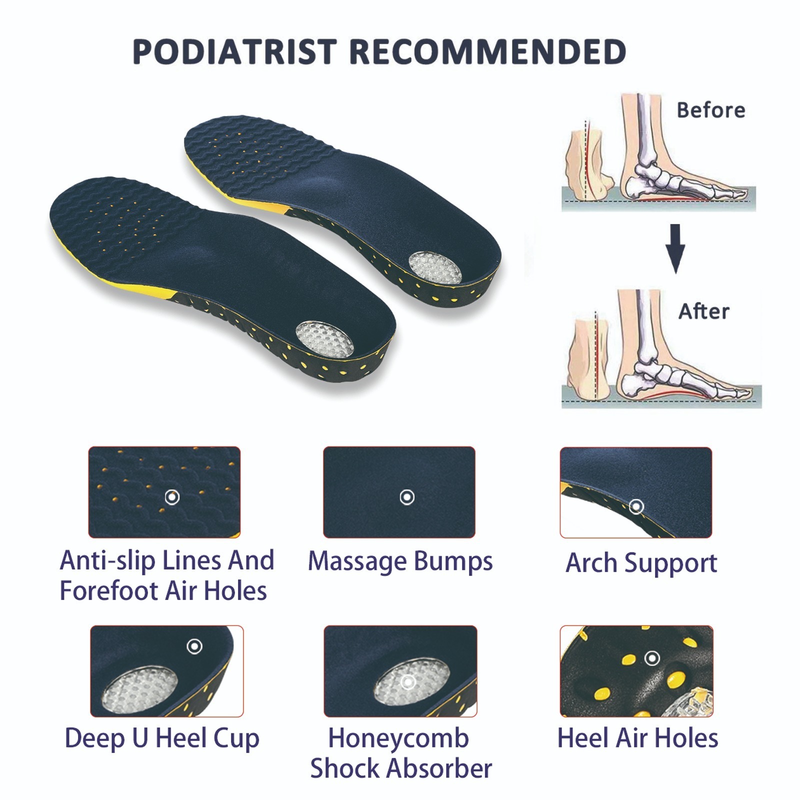 hard arch support for flat feet