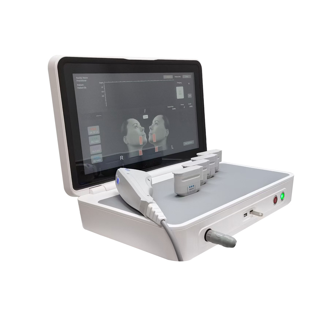 HIFU Machine SMAS Face Lift