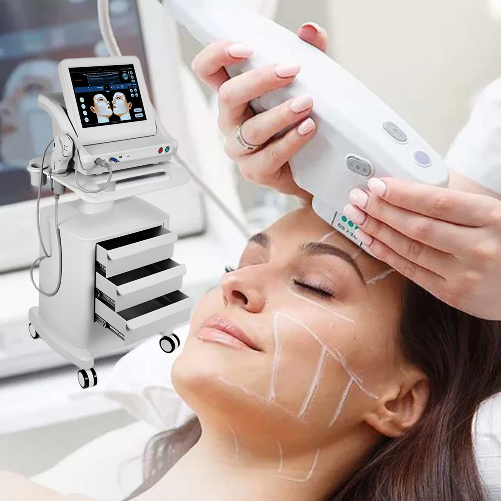 HIFU Machine SMAS Face Lift