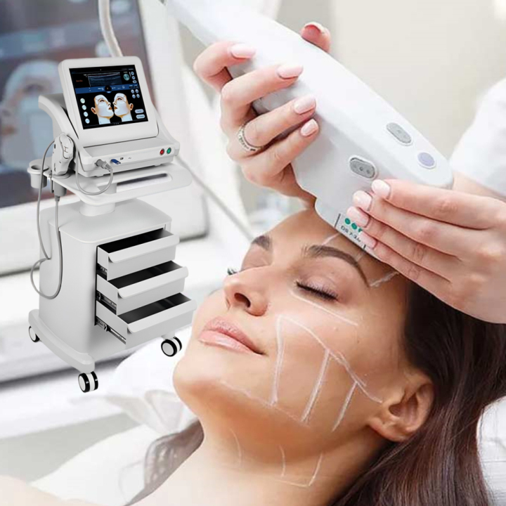 HIFU Machine SMAS Face Lift