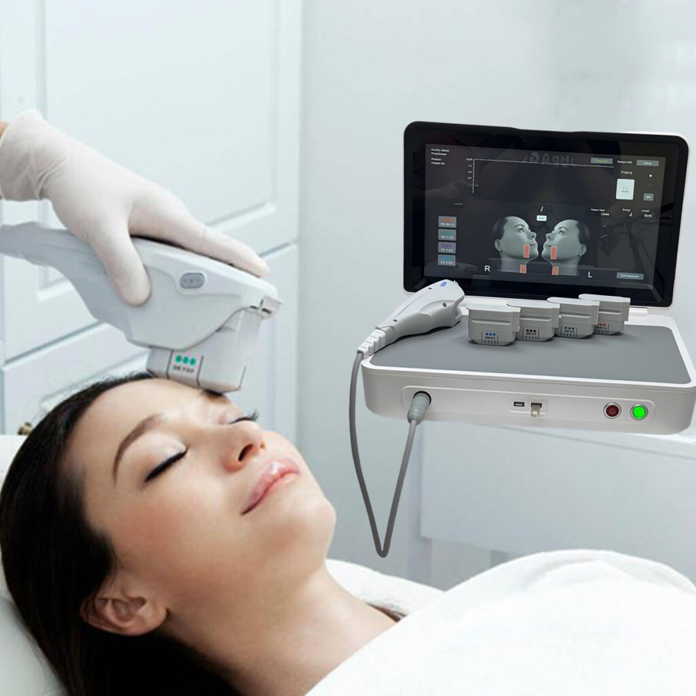 HIFU Machine SMAS Face Lift