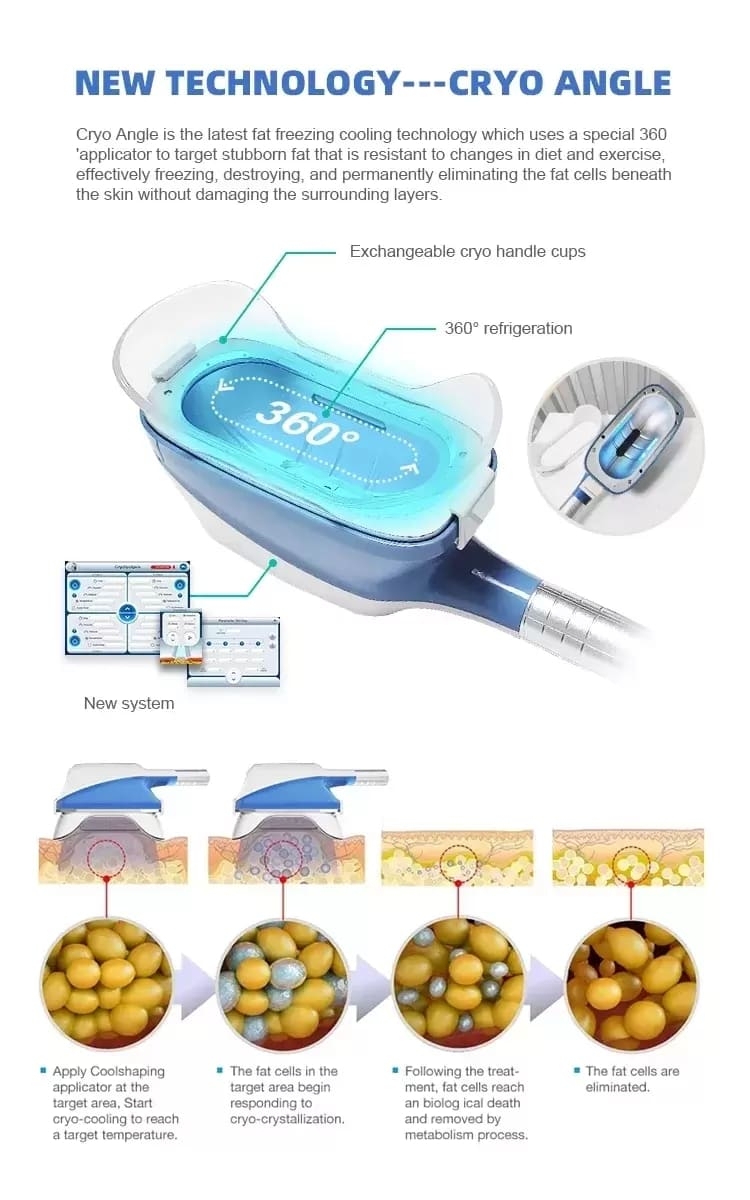 New Arrival 360 lipo cryo cool tech criolipolisis slimming coolsculption fat freezing radio frequency weight loss cryolipolysis machine 5 in 1 360 Cryolipolysis Machine | Honkay cryolipolysis machine,fat freezing machine,criolipolisis slimming machine