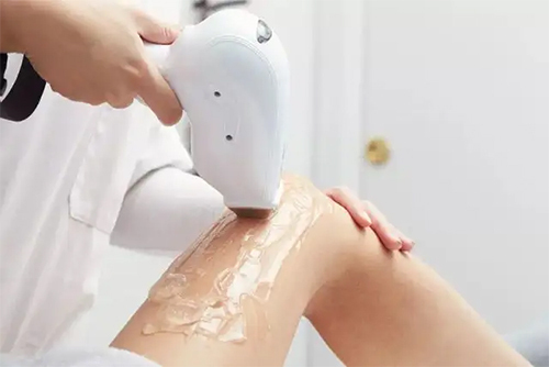 Laser Hair Removal