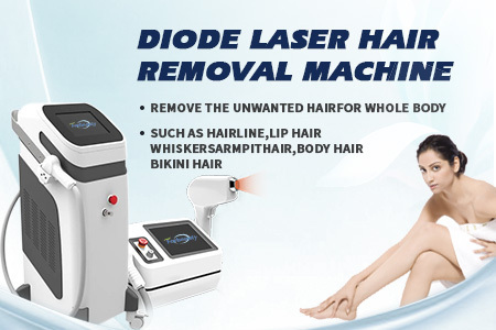 Laser Hair Removal
