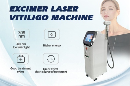 Excimer Laser Machine  