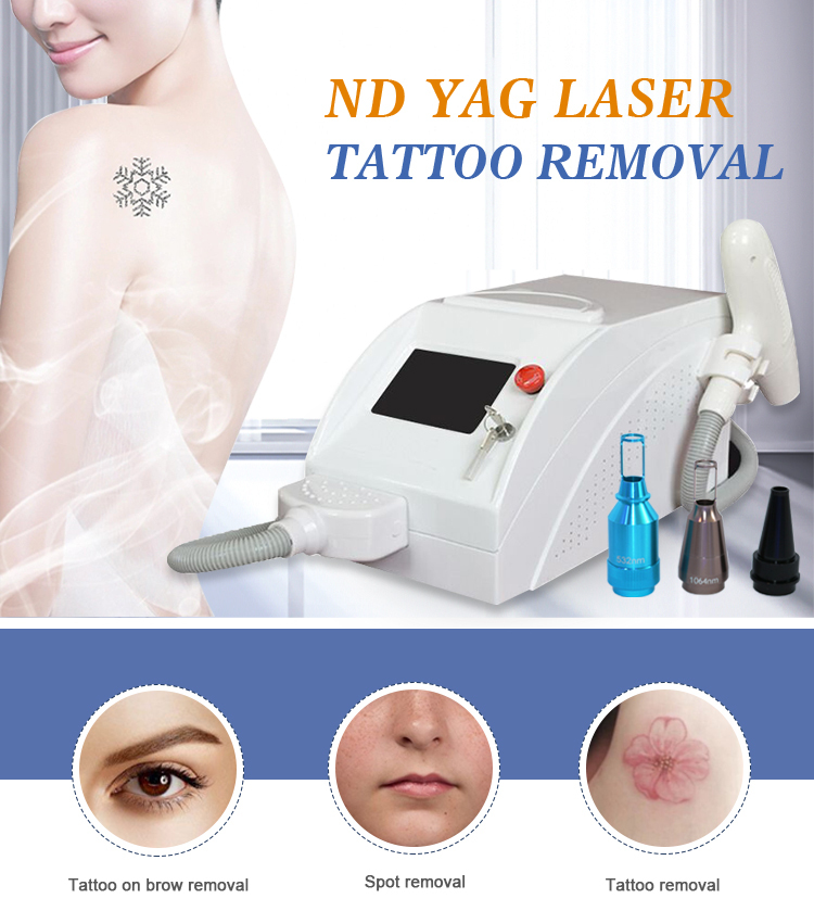 Laser Tattoo Removal Machine  