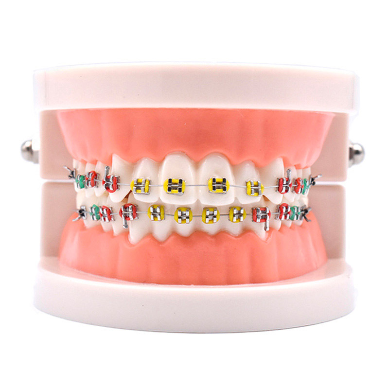 Dental Orthodontic Standard Teeth Model With Metal Brackets Wires