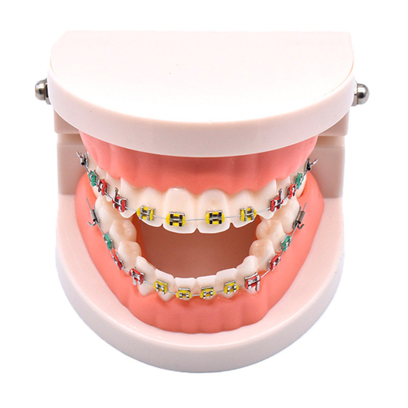 Dental Orthodontic Standard Teeth Model With Metal Brackets Wires