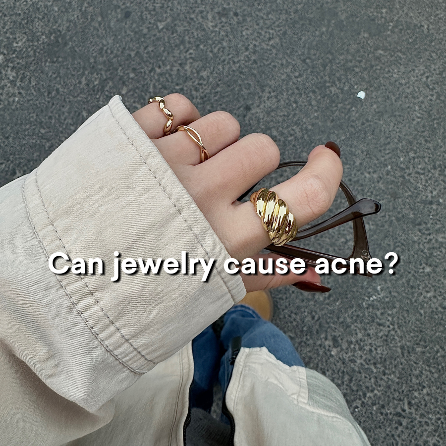 Can jewelry cause acne?