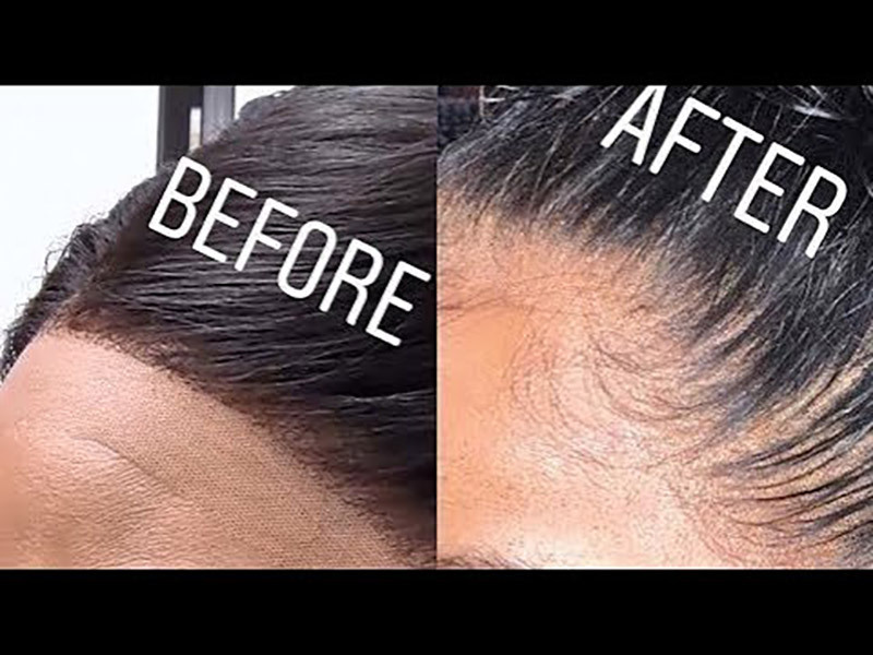 How to Pluck a Wig