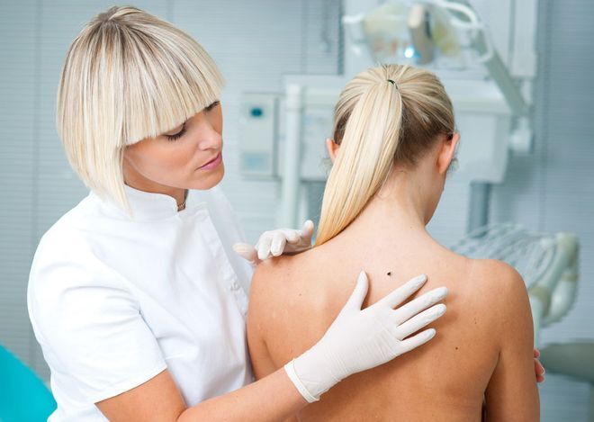 Can I use A Mole Removal Pen to Safely Remove My Moles at Home?
