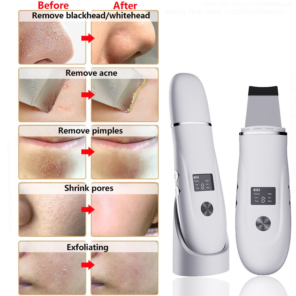 Ultrasonic Cleaner Peeling Remover Blackhead Facial Skin Scrubber Facial Shovel Deep Cleaning Face Lifting Removal Pore Acne EMS 