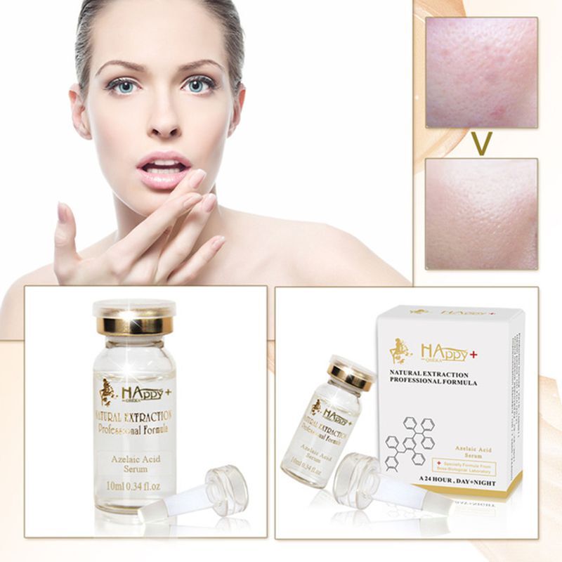 best essence for acne