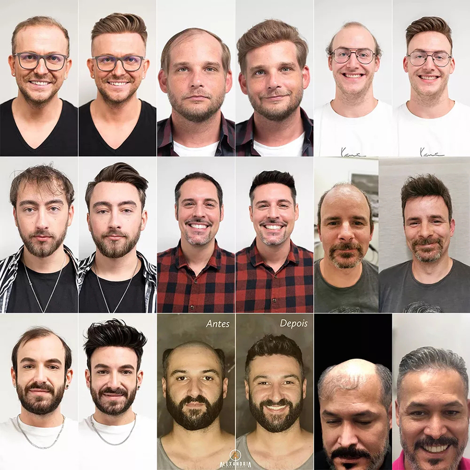 men's toupee