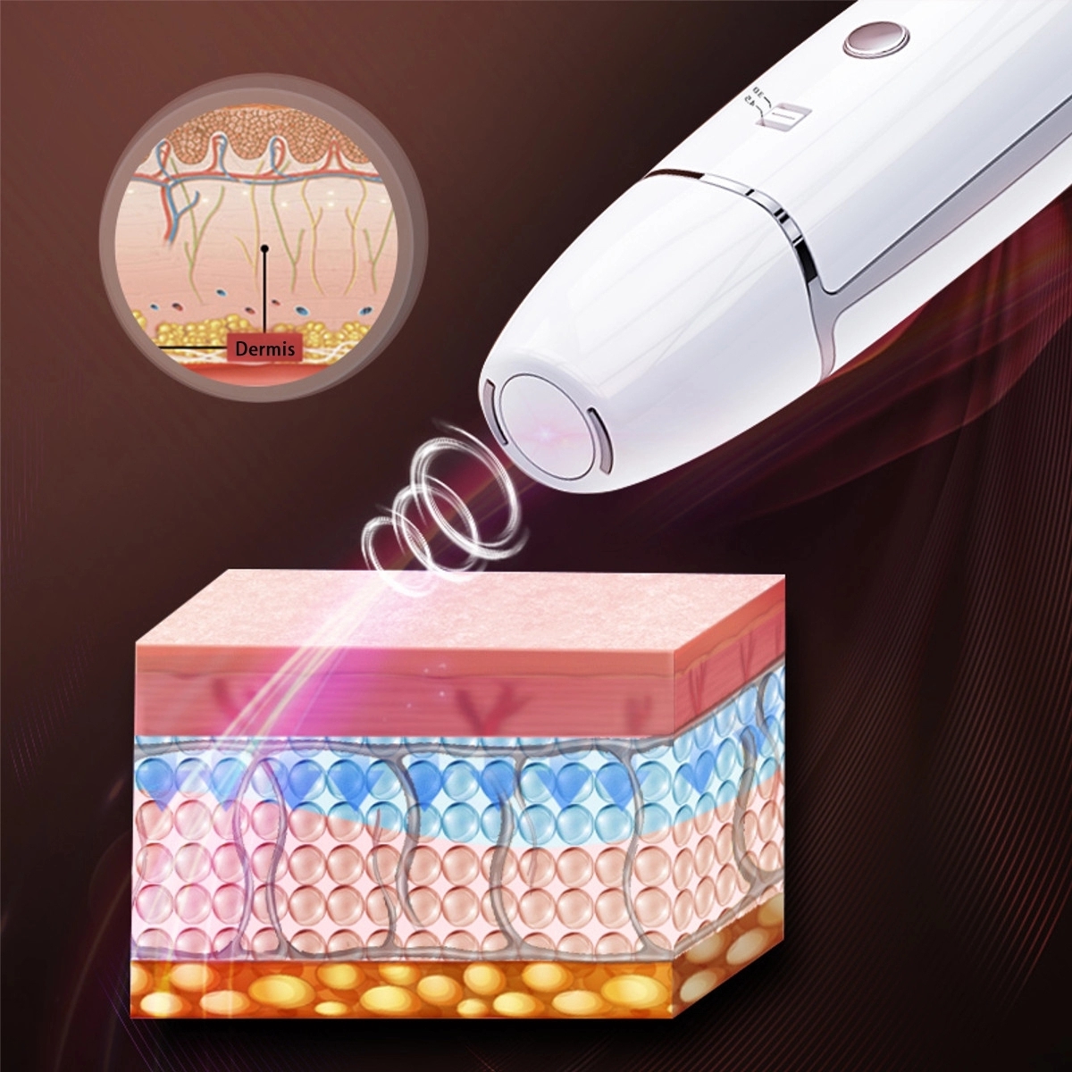 radar line V max hifu