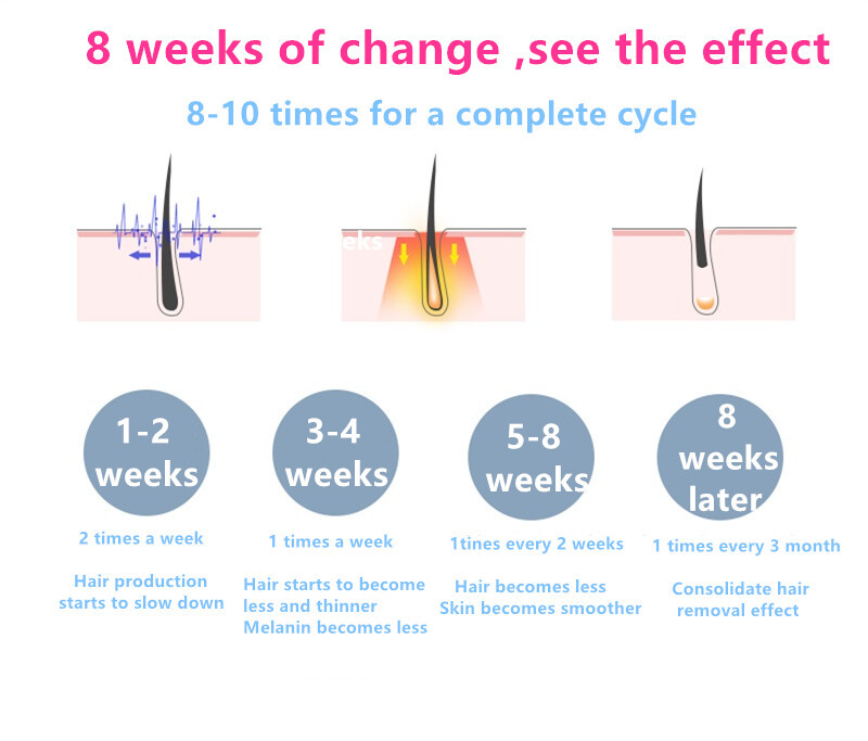 Home use IPL Laser Hair Removal