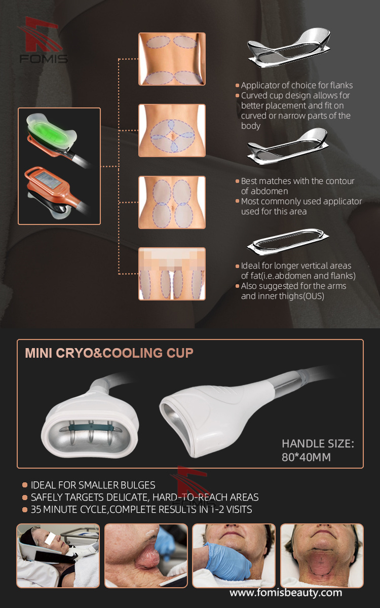5 IN 1 Criolipolisis Coolsculption weight loss cryolipolysis machine