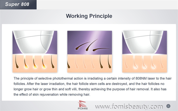 Super 808 Most Effective Diode Laser for Permanent Painless Hair Removal Machine